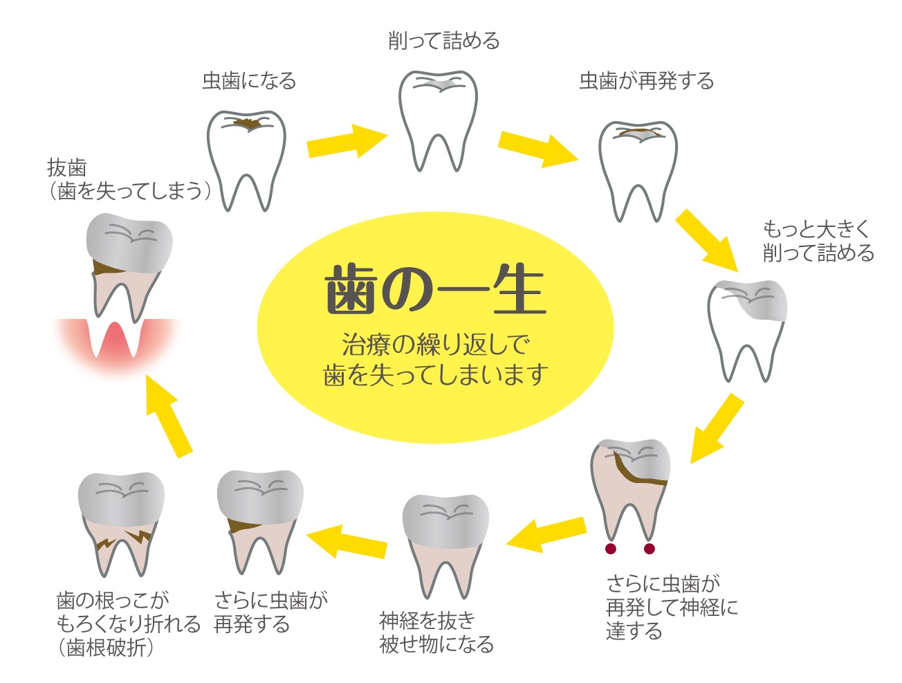 歯の一生🦷