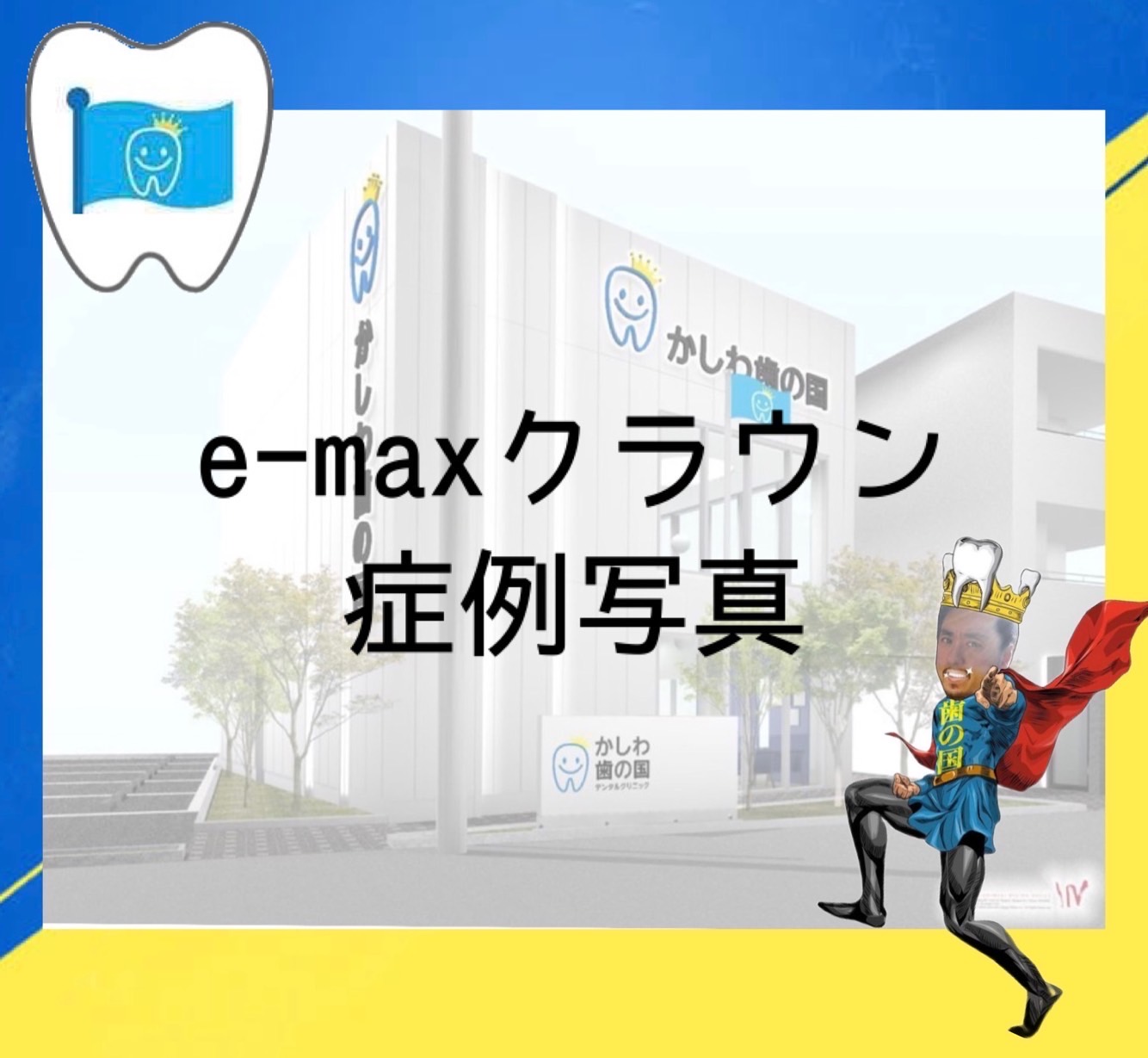 e-Maxクラウンの症例写真