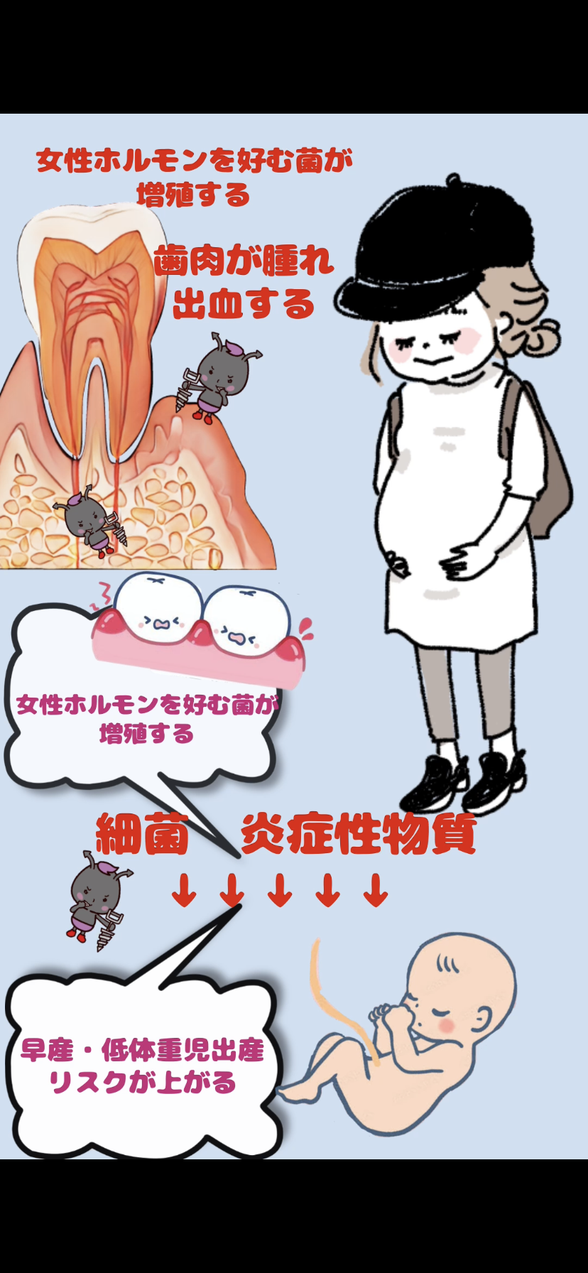 妊婦さんの歯周病のおはなし